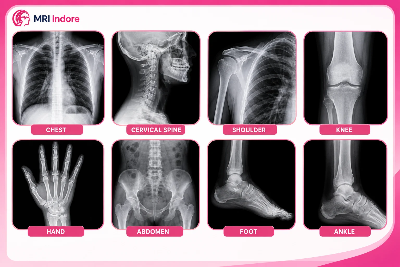 High-resolution digital X-ray machine in Indore